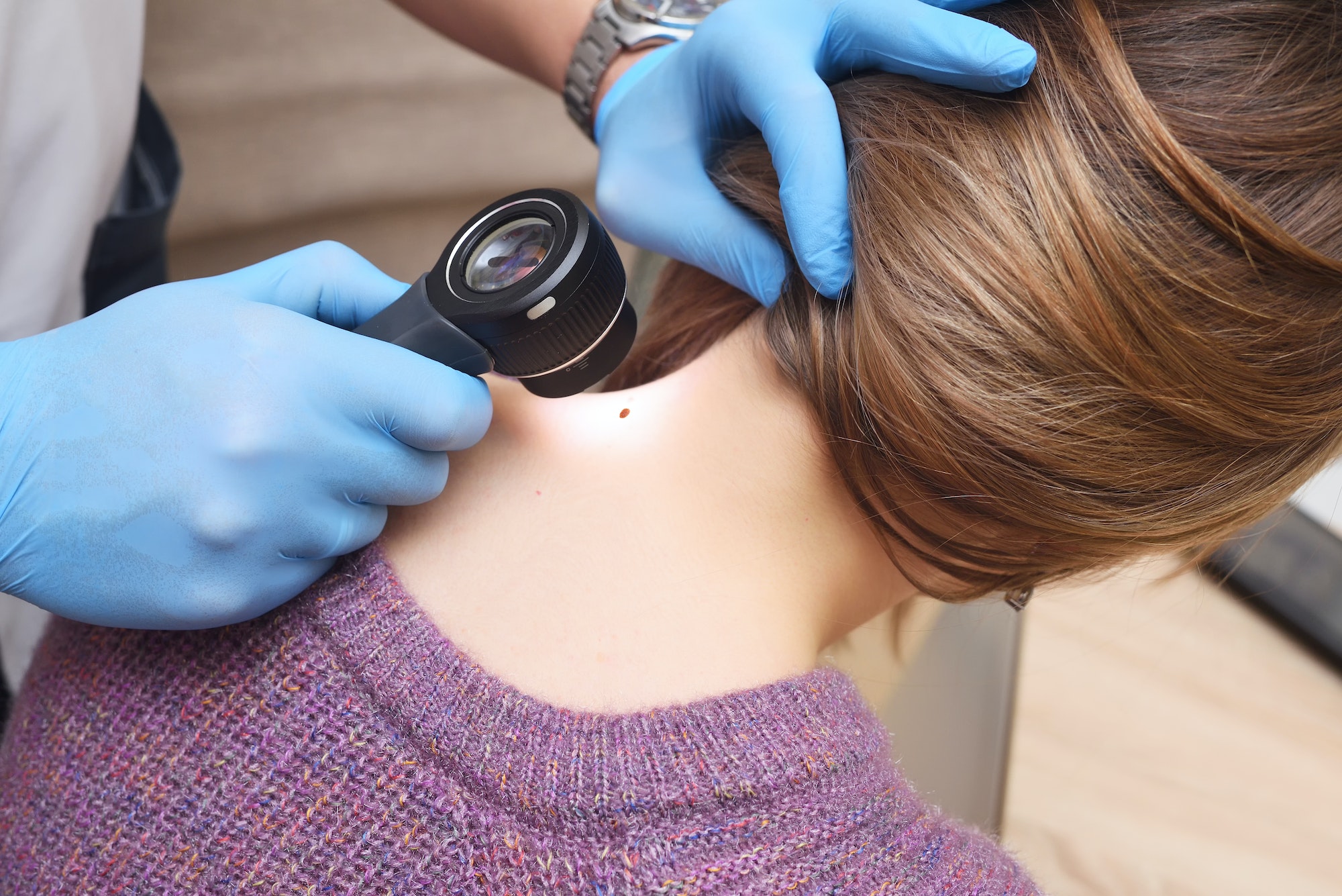 dermatologist examines a mole on the patient's neck using a special device - a dermatoscope